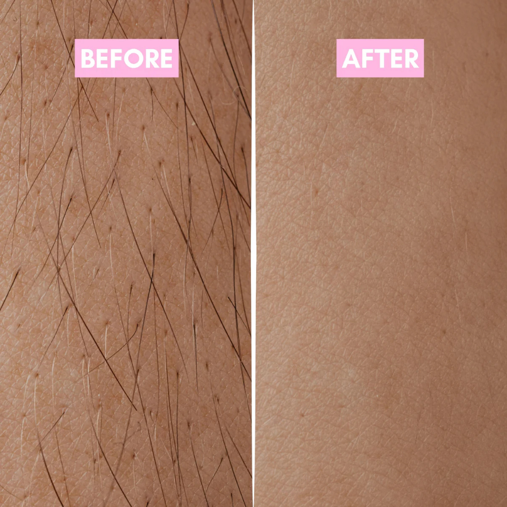 Cyperus Rotundus Serum